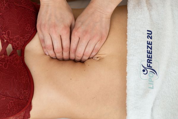 diastasis recti treatment Tyne & Wear