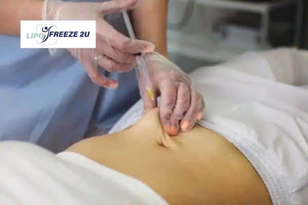 Fat Dissolving Injections Tyne & Wear & Weight loss medication