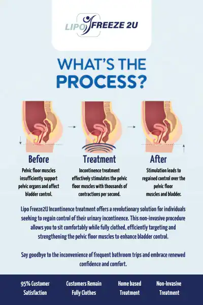 Diagram of how incontinence treatment Tyne & Wear works.