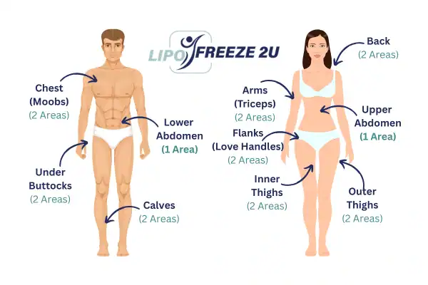Areas you can have fat freezing treatment Tyne & Wear
