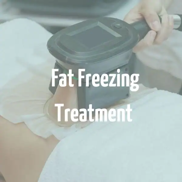 fat freezing treatment Tyne & Wear