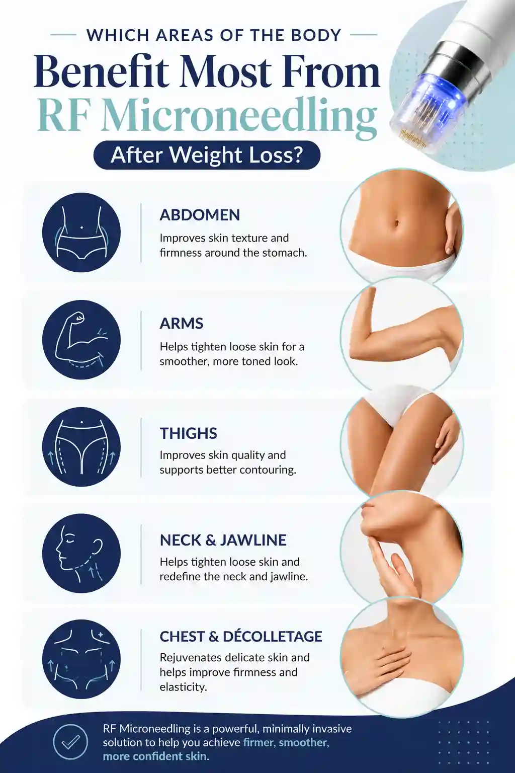 Which Areas of the Body Benefit Most From RF Microneedling After Weight Loss Tyne & Wear